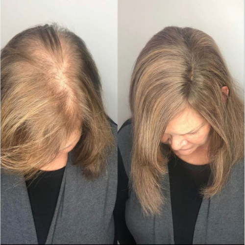 Instagram Image